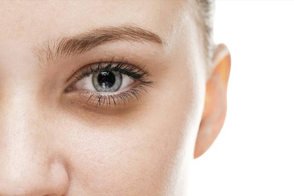 Mắt thâm quầng là một tình trạng khá phổ biến